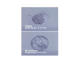 Embryo thaw