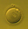 normally fertilized human embryo