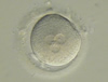 abnormally fertilized human embryo 