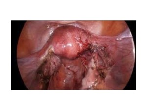 Saliva tests for ovulation