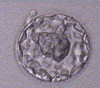 day 5 blastocyst implantation timeline ivf
