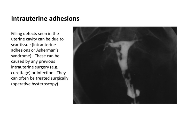 Slide7