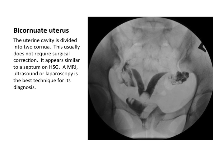 Slide4