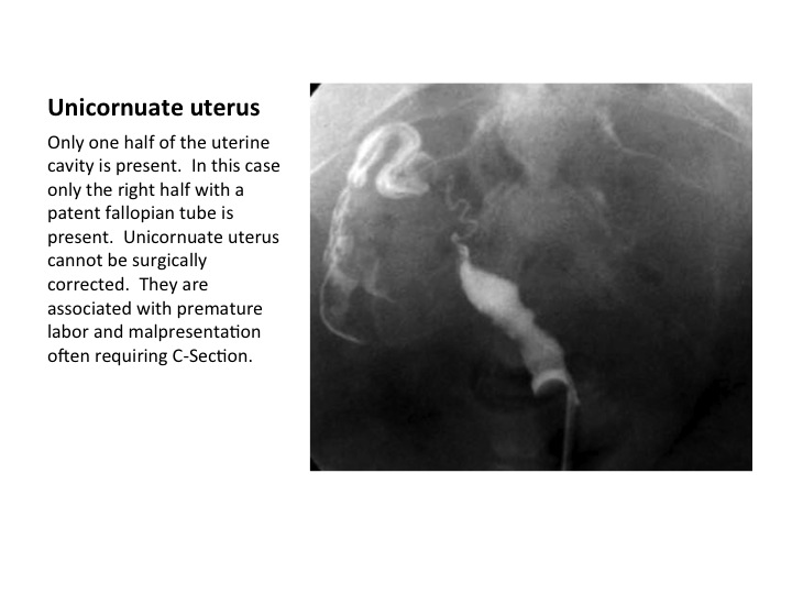 Slide5