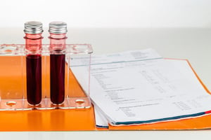 ovarian reserve testing blood samples