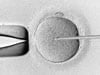 embryo development IVF 1