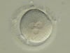 embryo development IVF 3