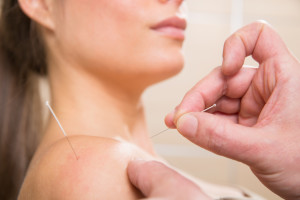 Increasing pregnancy rates with acupuncture during IVF