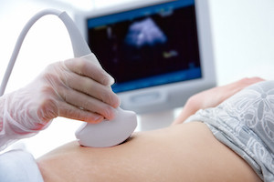 hCG Levels after Single Embryo Transfer