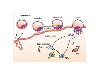 Letrozole vs. Clomid