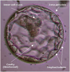 blastocyst grading - blastocyst structure