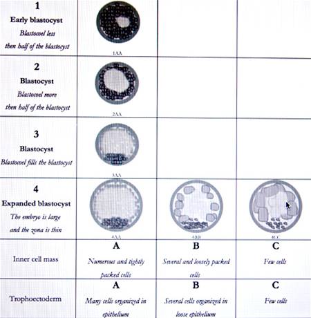 blastocyst grading criteria