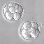 embryo development IVF 5