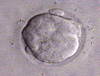 embryo development IVF 6