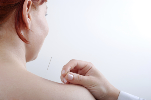 success of acupuncture during ivf
