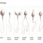 Abnormal sperm morphology