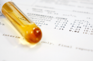 high amh level anti mullerian hormone level test results