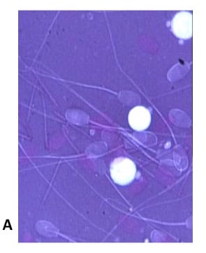 white-blood-cells-in-semen-1-1.jpg